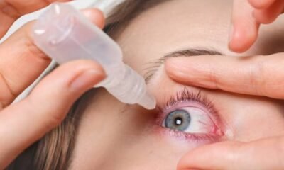 Wax in Eye Causes, Symptoms, and Treatment