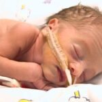 Baby with rare lung condition