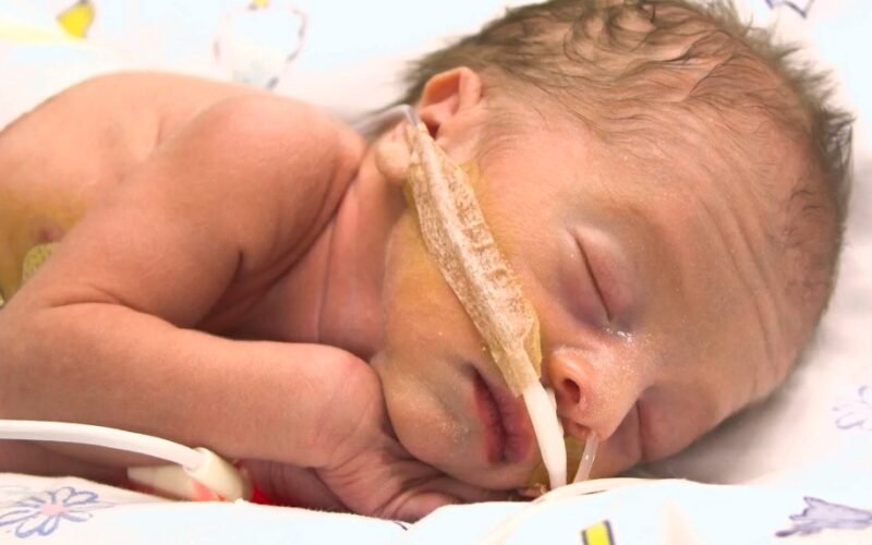 Baby with rare lung condition defies odds and survives