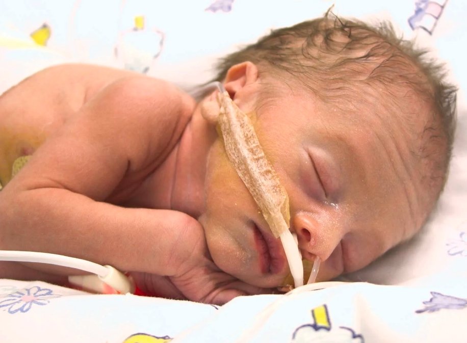 Baby with rare lung condition 