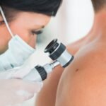 The MOLE Clinic Expands Skin Cancer Screening Services to Scotland