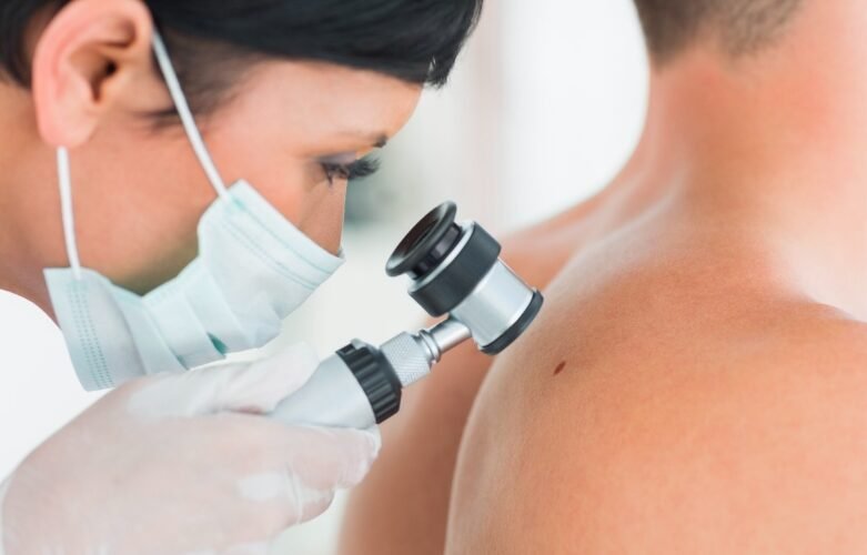The MOLE Clinic Expands Skin Cancer Screening Services to Scotland