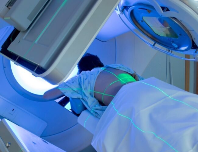 Cancer Treatment Delays in Scotland Hit Record High, Prompting Growing Alarm